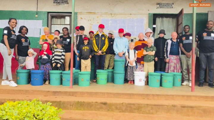 #KIRUNDO: ASSISTANCE AUX PERSONNES A BESOINS SPECIFIQUES (ALBINOS).